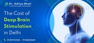 The Cost of Deep Brain Stimulation in Delhi